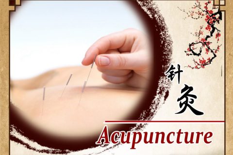 Acupuncture | 针灸