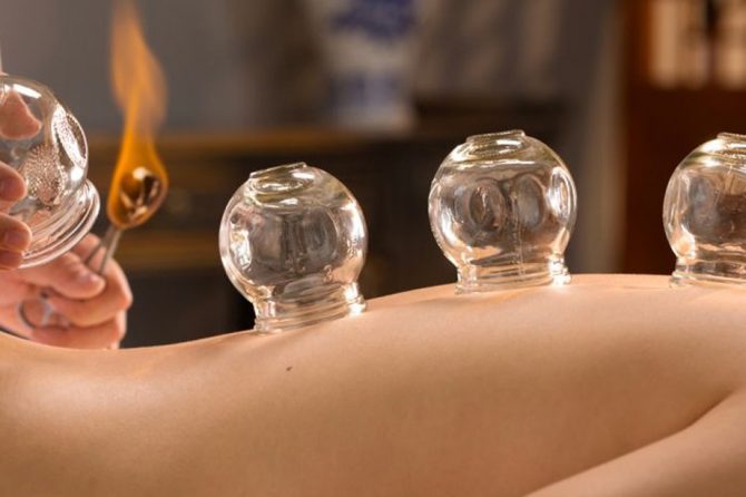 Could ‘cupping’ technique boost vaccine delivery?